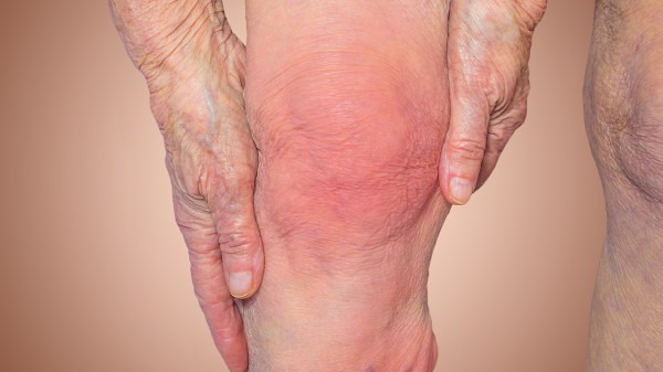 老年人一定要警惕下肢动脉硬化闭塞症。黑龙江看下肢动脉硬化闭塞症好的医院